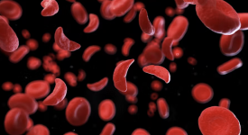 Drépanocytose